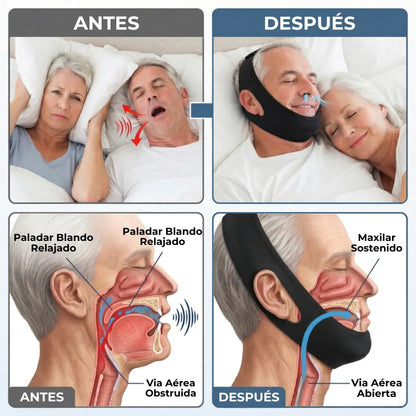 Cómo Funciona la Banda Anti Ronquidos - Antes y Después